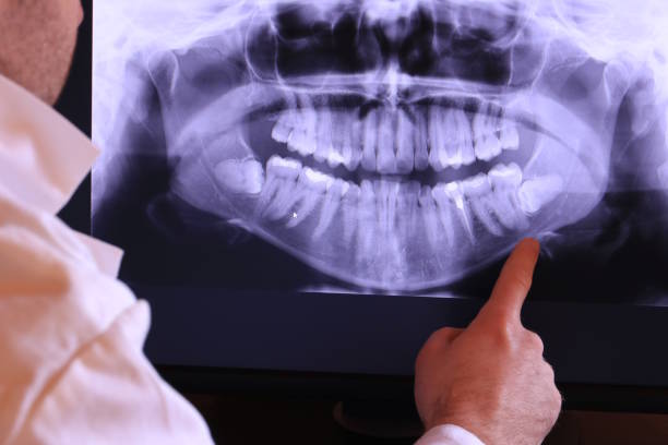 Best Weekend Emergency Dentist in Blanco, TX