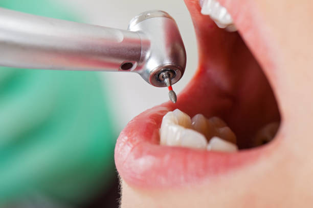Best Emergency Dentist for Knocked-Out Tooth in Blanco, TX